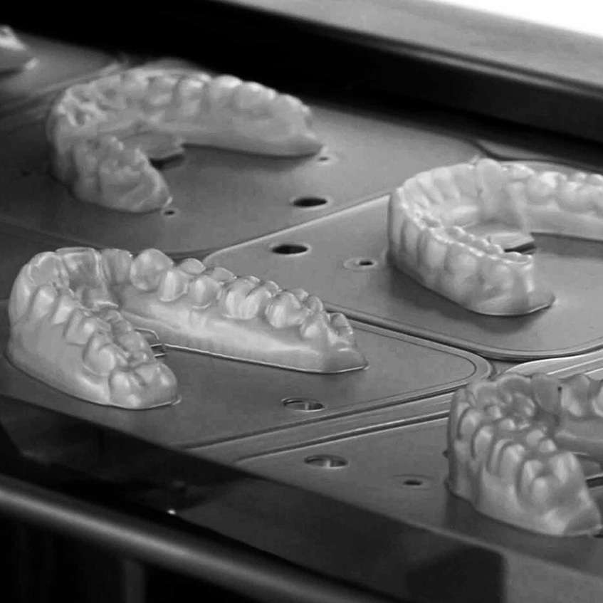 3D Custom-made Aligners & Retainers