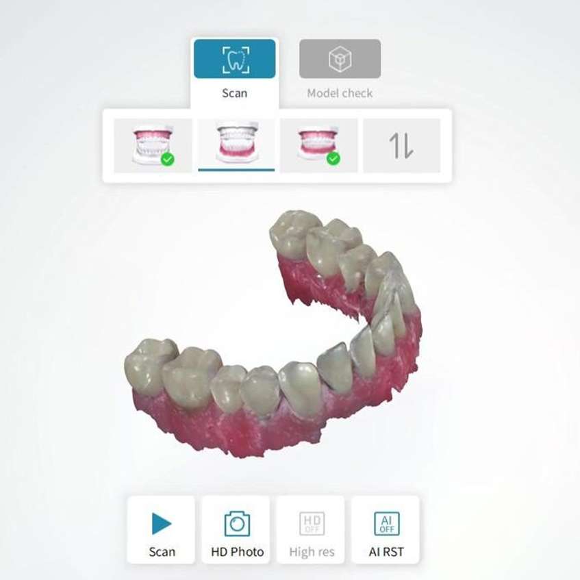 3D Treatment Plan and Smile Summary