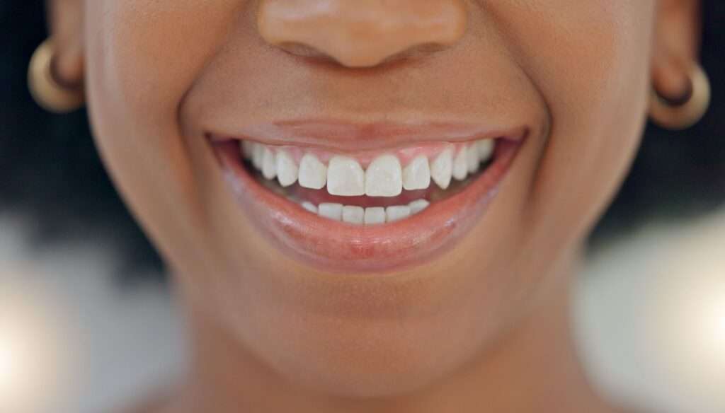 Woman smiling and seen from the nose down to her chin.