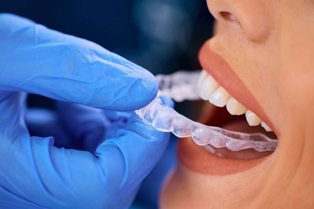 Close-up of a woman with transparent braces on her teeth.