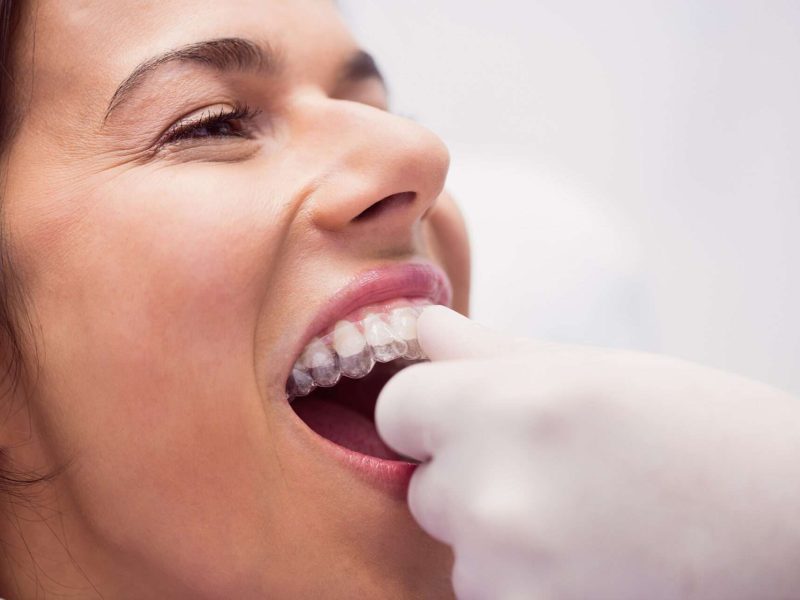 Dentist assisting woman with Invisalign retainer